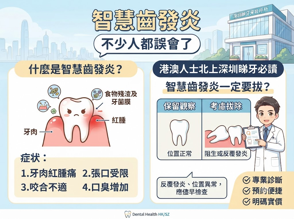 智慧齒發炎可以唔拔嗎？牙醫分析發炎原因、治療方法及是