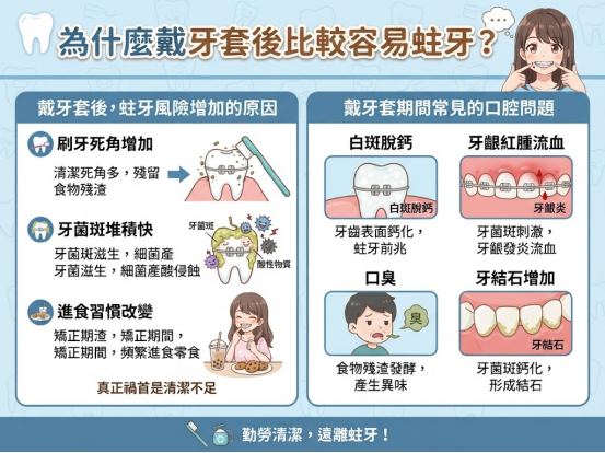戴牙套怎麼刷牙才乾淨？降低蛀牙風險的清潔方法一次看懂