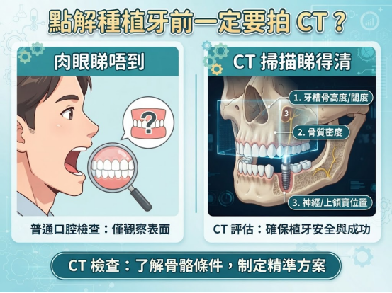 種植牙前一定要拍CT?唔係每個人都可以直接種牙